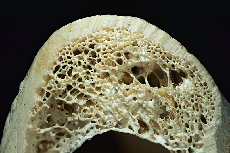 Trabecular internal structure of bone