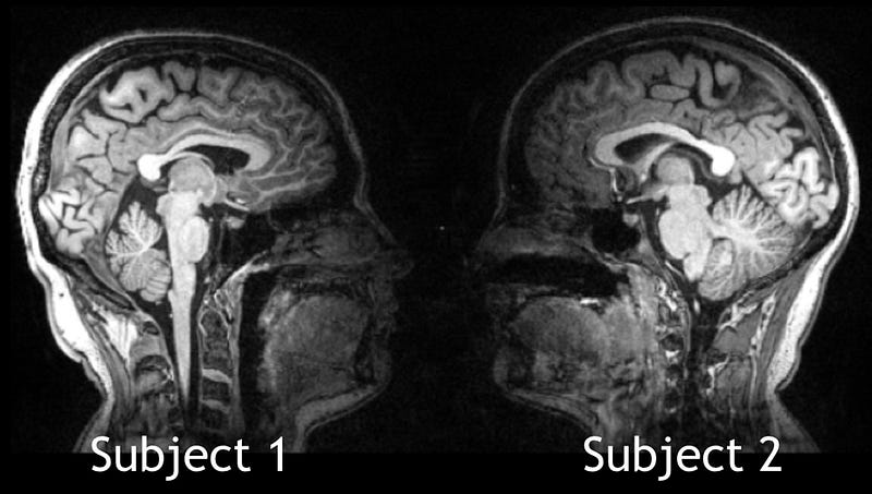 Visualization of brain activity during interaction