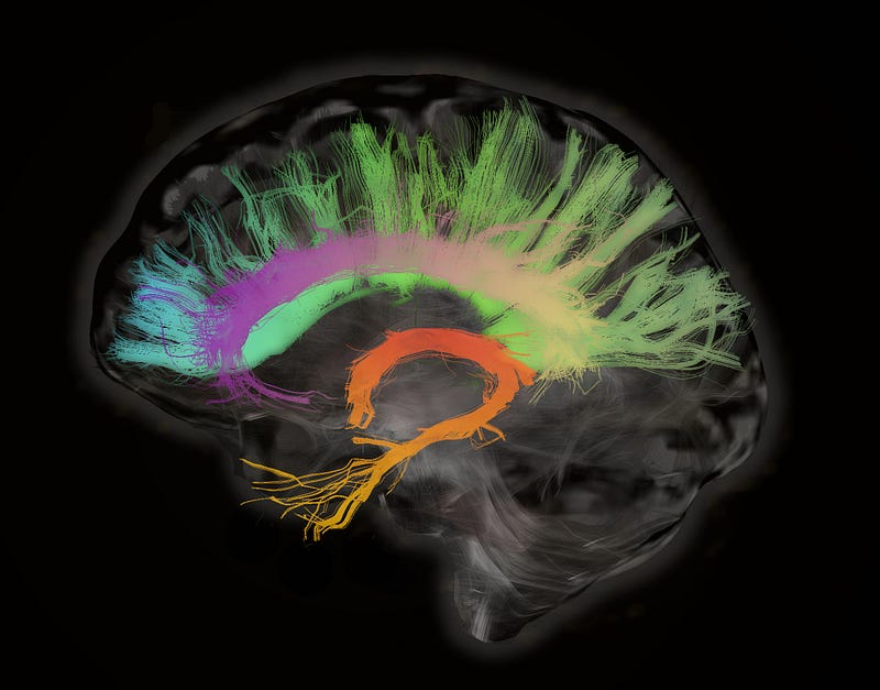 A representation of cognitive resilience